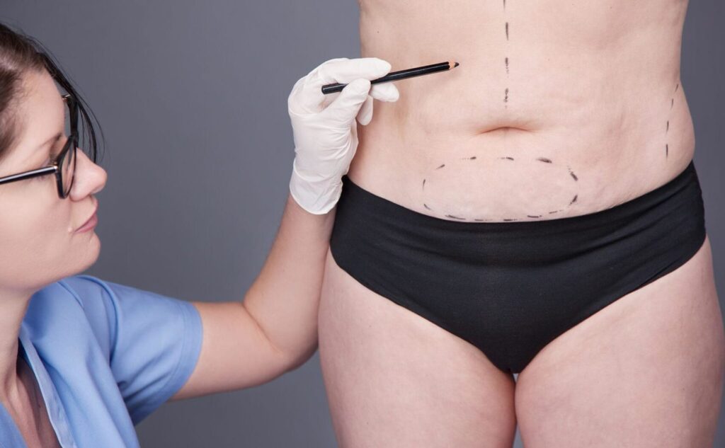 Weight Loss Surgeries