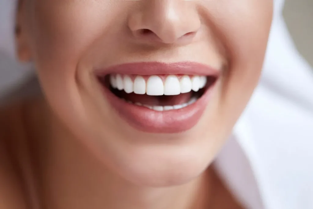 Gummy Smiles